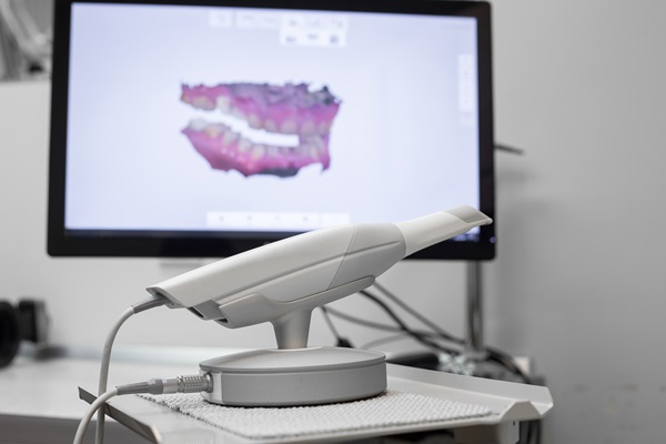 Commonly Asked Questions About CEREC Same Day Crowns