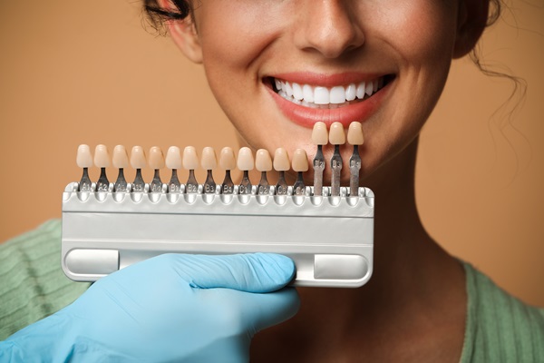 The Process Of Getting Dental Veneers: What To Expect