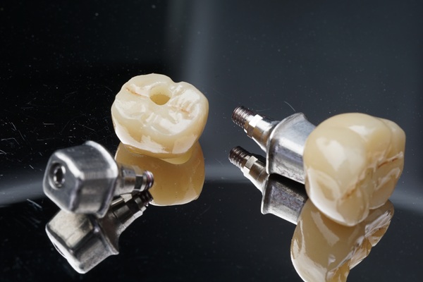 How To Extend The Life Of Your Implant Crown