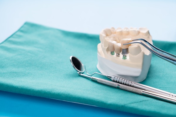 Visit A Prosthodontist For Tooth Replacement